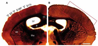 Structural and Synaptic Organization of the Adult Reeler Mouse Somatosensory Neocortex: A Comparative Fine-Scale Electron Microscopic Study of Reeler With Wild Type Mice